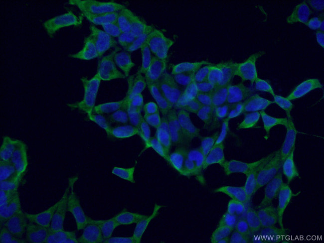 COPE Antibody in Immunocytochemistry (ICC/IF)