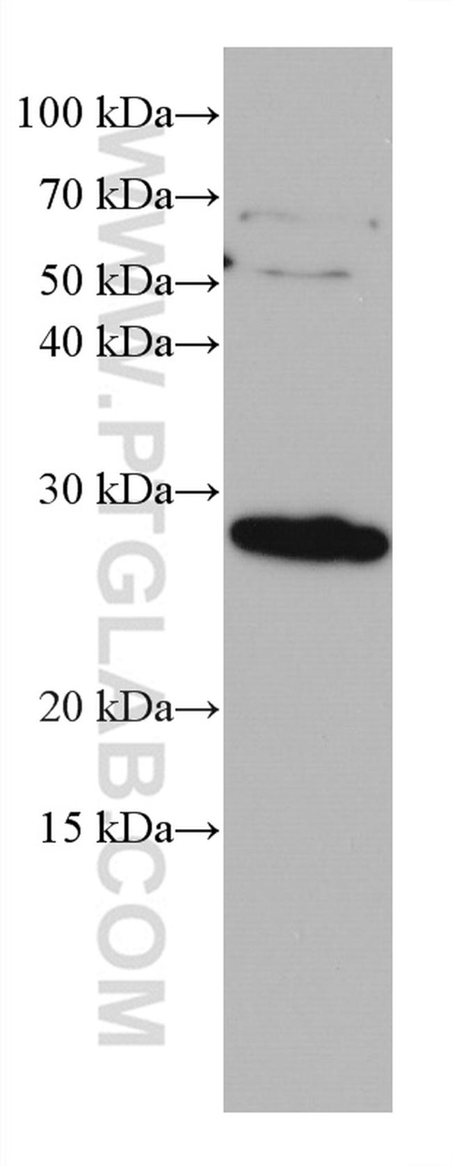 Endothelin 1 Antibody in Western Blot (WB)