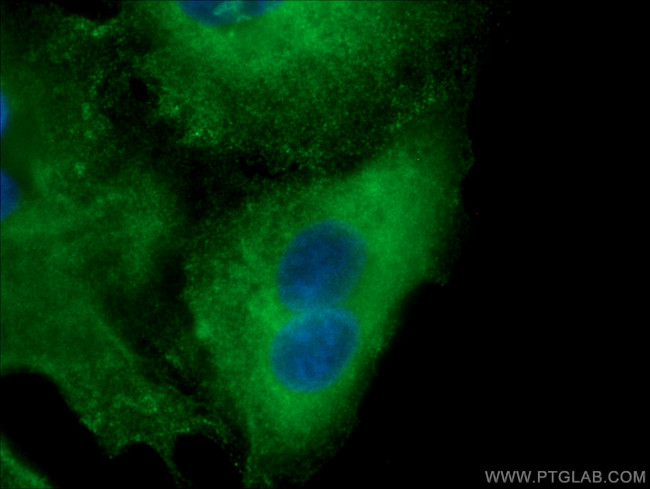 FMO2 Antibody in Immunocytochemistry (ICC/IF)