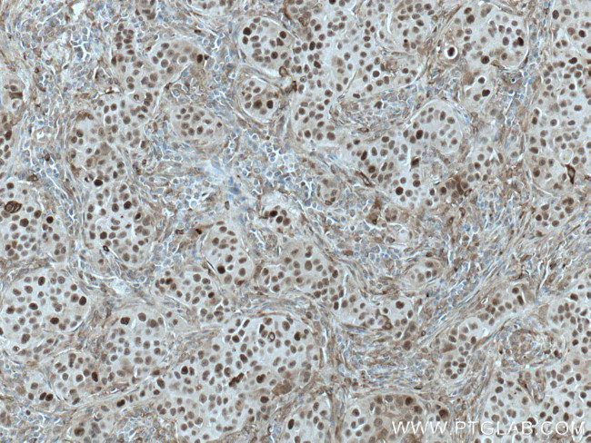 PRC1 Antibody in Immunohistochemistry (Paraffin) (IHC (P))