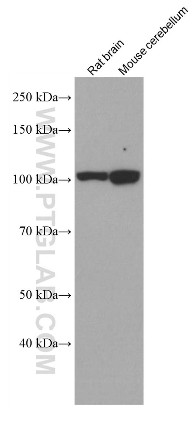 EPAC2 Antibody in Western Blot (WB)