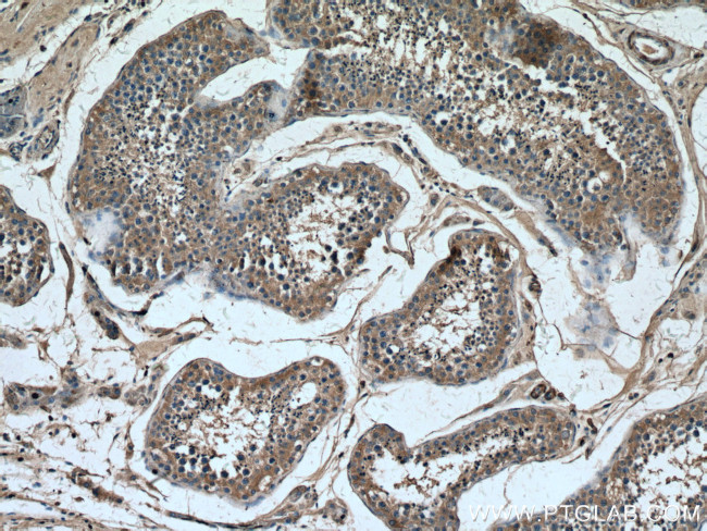 PLCD1 Antibody in Immunohistochemistry (Paraffin) (IHC (P))