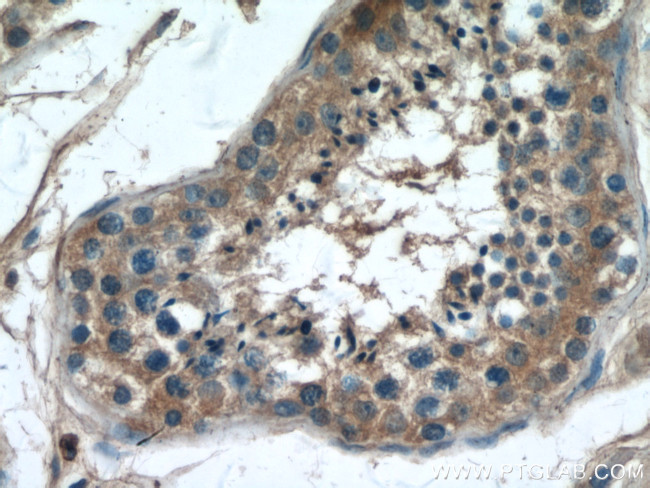 PLCD1 Antibody in Immunohistochemistry (Paraffin) (IHC (P))