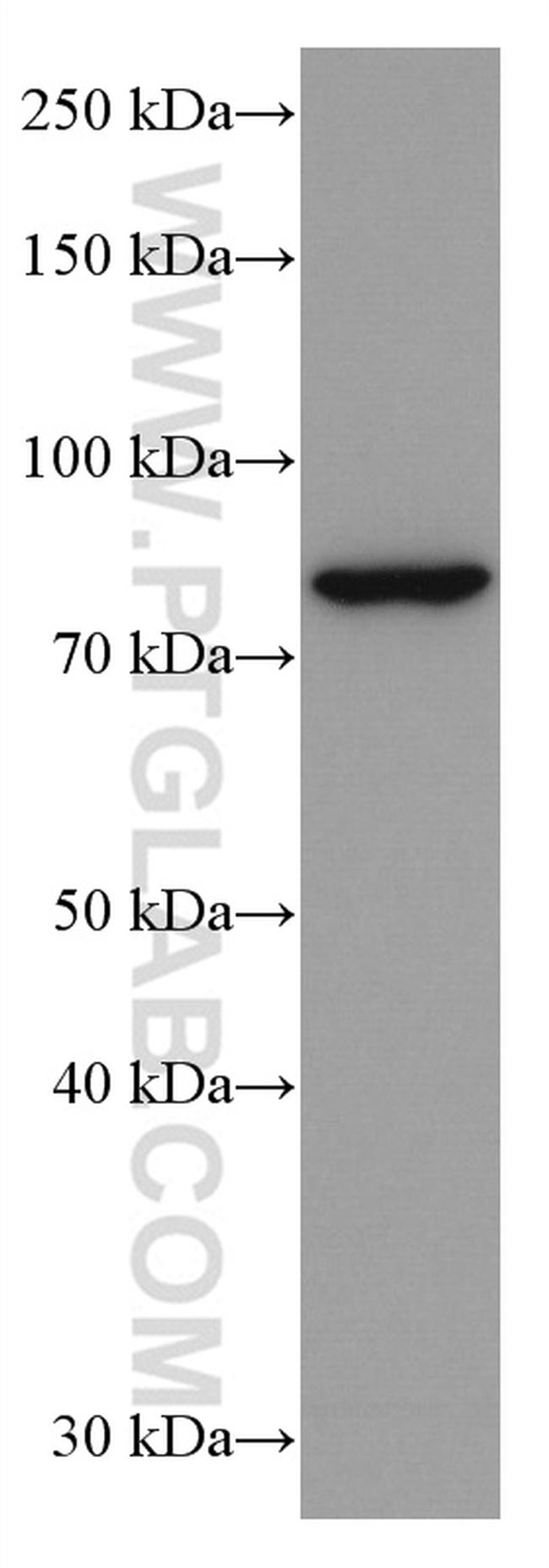 PLCD1 Antibody in Western Blot (WB)