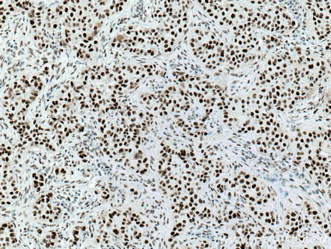 Cyclin H Antibody in Immunohistochemistry (Paraffin) (IHC (P))