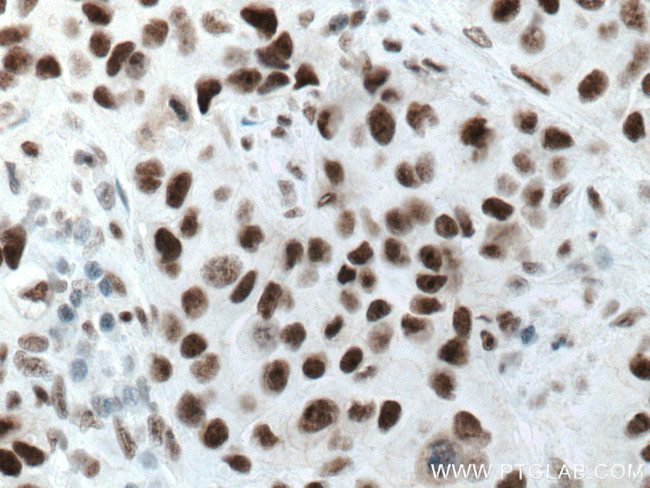 Cyclin H Antibody in Immunohistochemistry (Paraffin) (IHC (P))