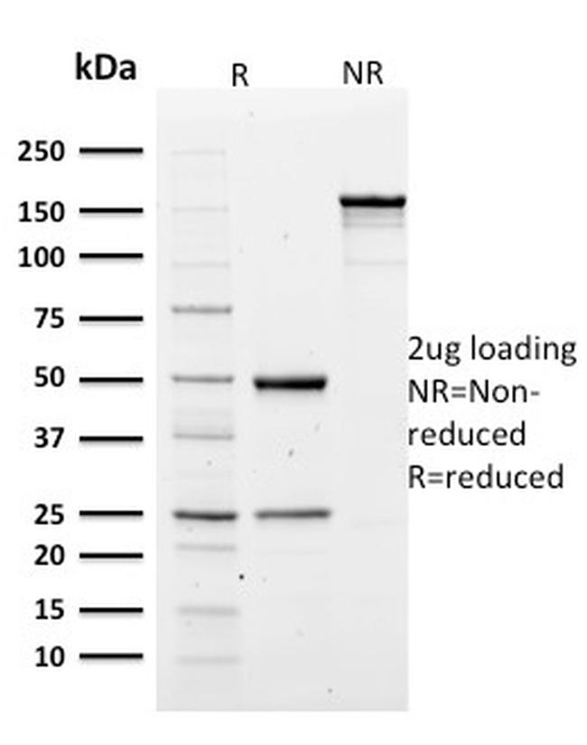 Spectrin Alpha 1 Antibody in SDS-PAGE (SDS-PAGE)