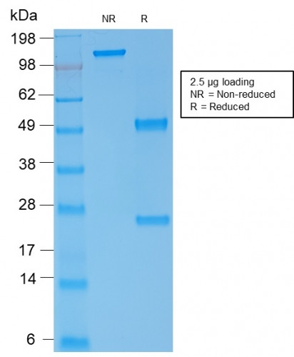 Spectrin Alpha 1 (Erythrocyte Marker) Antibody in SDS-PAGE (SDS-PAGE)