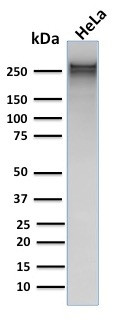 Spectrin Alpha 1 (Erythrocyte Marker) Antibody in Western Blot (WB)