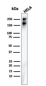 Spectrin beta III (SPTBN2) Antibody in Western Blot (WB)