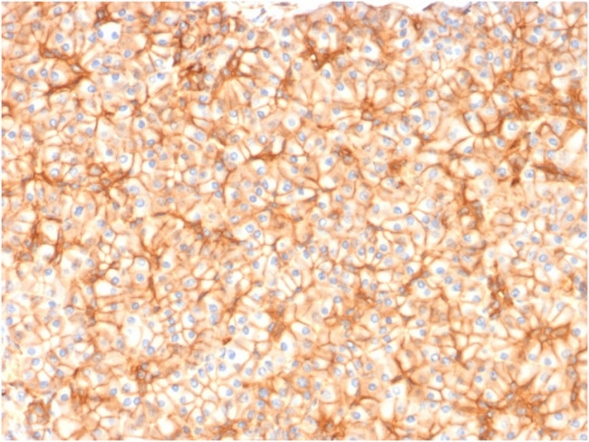 Spectrin beta III (SPTBN2) Antibody in Immunohistochemistry (Paraffin) (IHC (P))