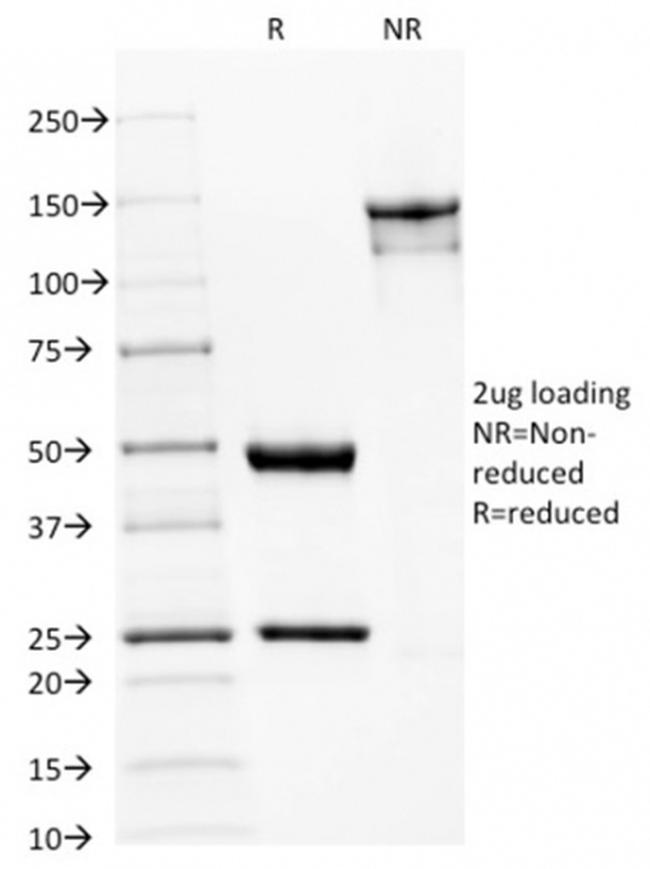 Spectrin beta III (SPTBN2) Antibody in SDS-PAGE (SDS-PAGE)