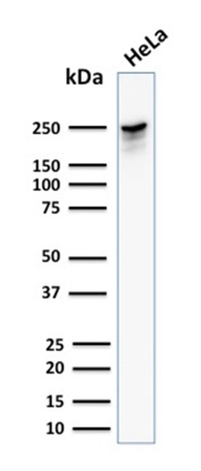 Spectrin beta III (SPTBN2) Antibody in Western Blot (WB)