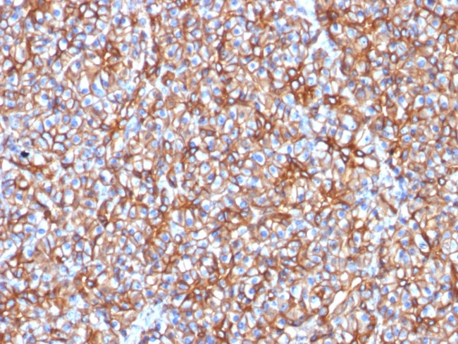 Spectrin beta III (SPTBN2) Antibody in Immunohistochemistry (Paraffin) (IHC (P))