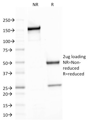 Spectrin beta III (SPTBN2) Antibody in SDS-PAGE (SDS-PAGE)