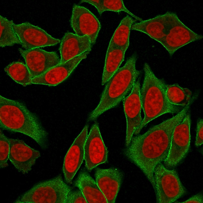 Spectrin beta III (SPTBN2) Antibody in Immunocytochemistry (ICC/IF)