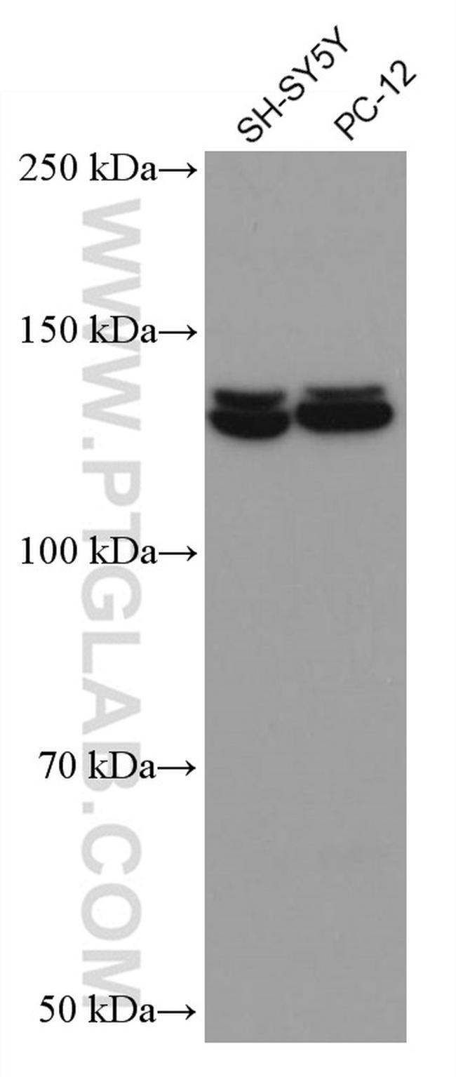 PI3 Kinase p110 Beta Antibody in Western Blot (WB)