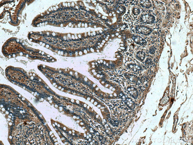 DEFA1 Antibody in Immunohistochemistry (Paraffin) (IHC (P))