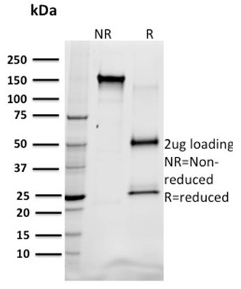 SREBP1 (Transcription Factor) Antibody in SDS-PAGE (SDS-PAGE)