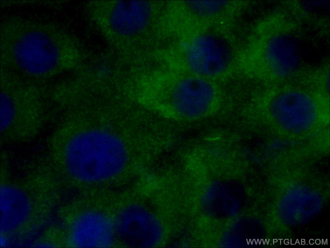 STMN2 Antibody in Immunocytochemistry (ICC/IF)