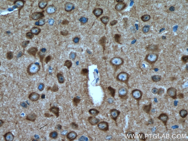 STMN2 Antibody in Immunohistochemistry (Paraffin) (IHC (P))