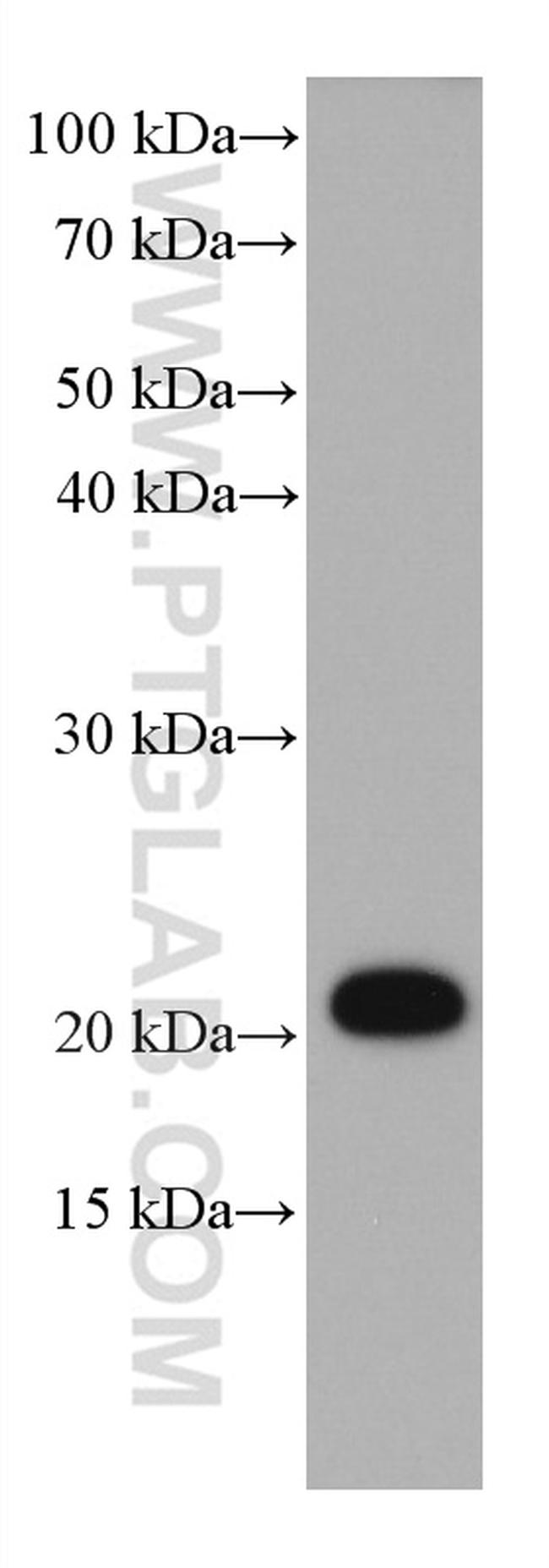 STMN2 Antibody in Western Blot (WB)