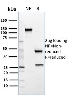 SREBP2 (Transcription Factor) Antibody in SDS-PAGE (SDS-PAGE)