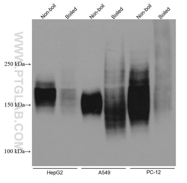 MRP4 Antibody in Western Blot (WB)