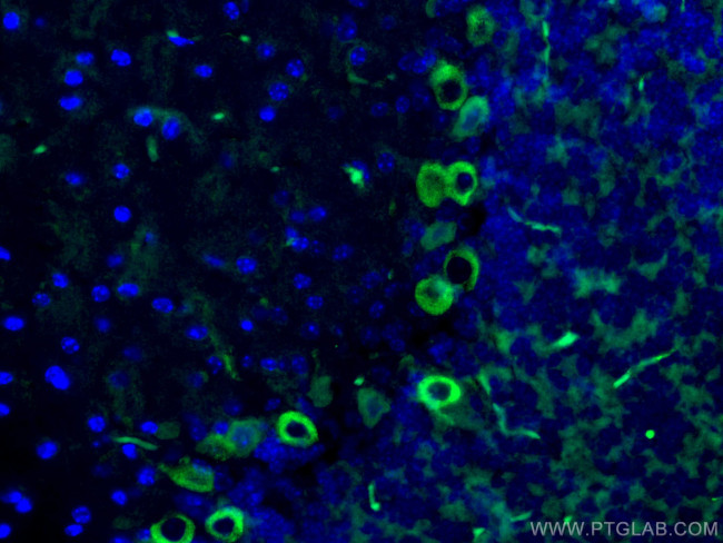 MYH10 Antibody in Immunohistochemistry (Paraffin) (IHC (P))