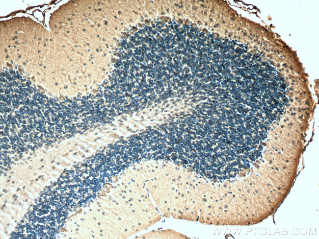 MYH10 Antibody in Immunohistochemistry (Paraffin) (IHC (P))