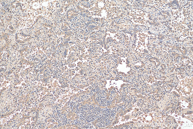 HDAC6 Antibody in Immunohistochemistry (Paraffin) (IHC (P))