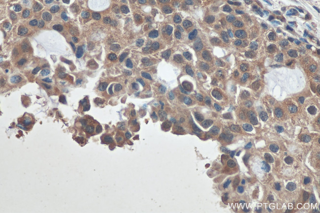 HDAC6 Antibody in Immunohistochemistry (Paraffin) (IHC (P))