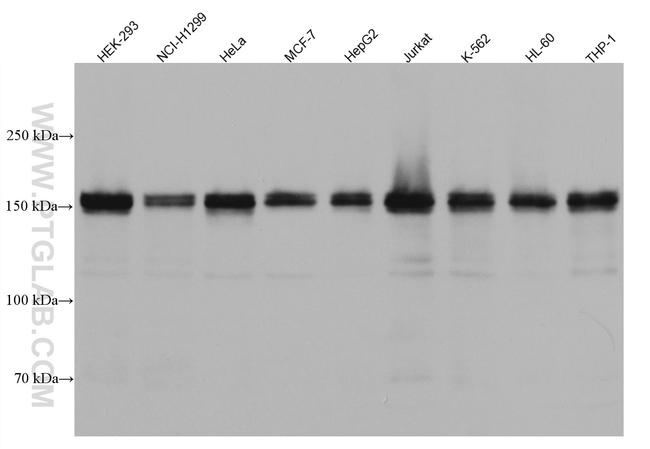 HDAC6 Antibody in Western Blot (WB)