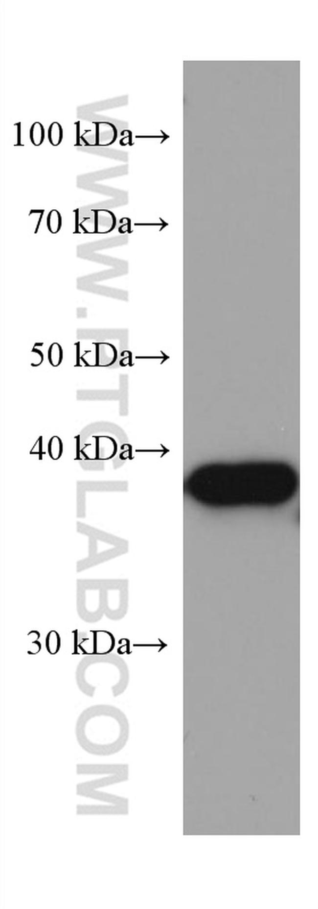 ZnT3 Antibody in Western Blot (WB)