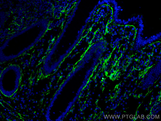 Collagen Type I Antibody in Immunohistochemistry (Paraffin) (IHC (P))