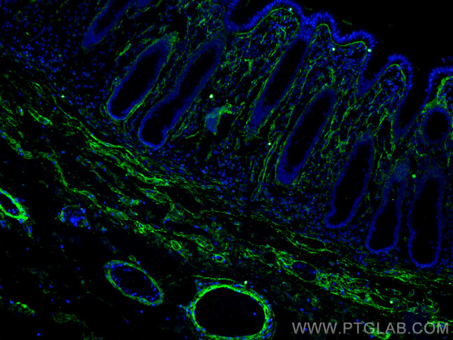 Collagen Type I Antibody in Immunohistochemistry (Paraffin) (IHC (P))