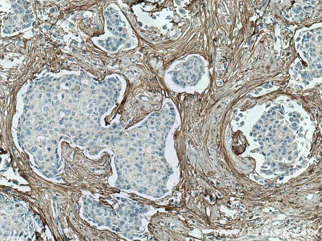 Collagen Type I Antibody in Immunohistochemistry (Paraffin) (IHC (P))