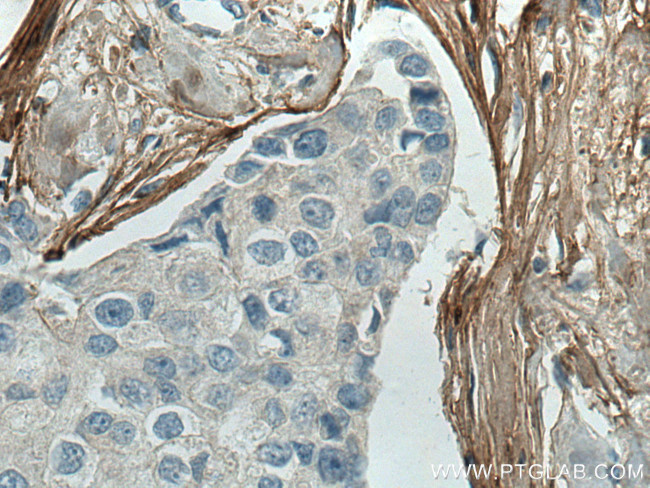 Collagen Type I Antibody in Immunohistochemistry (Paraffin) (IHC (P))