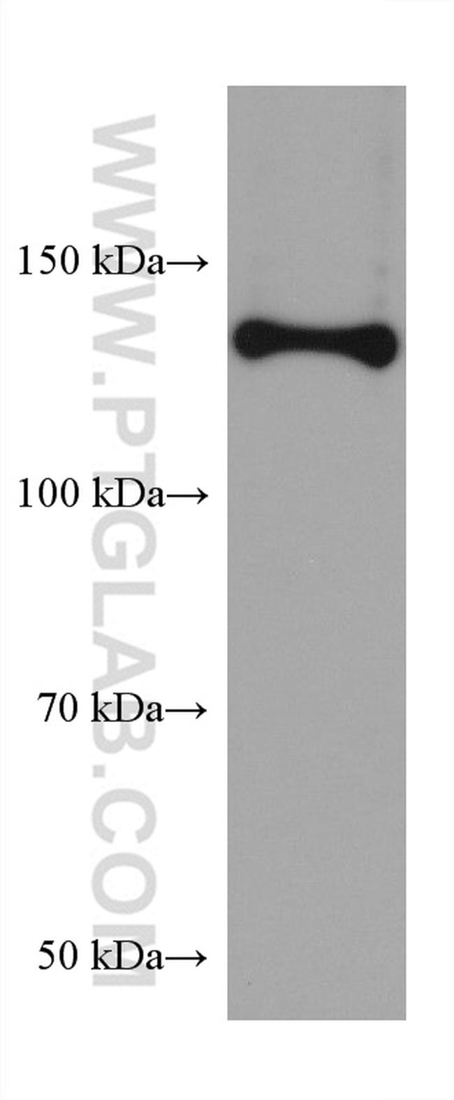 Collagen Type I Antibody in Western Blot (WB)