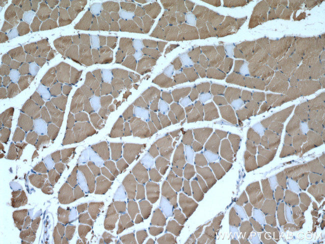 MYH1 Antibody in Immunohistochemistry (Paraffin) (IHC (P))