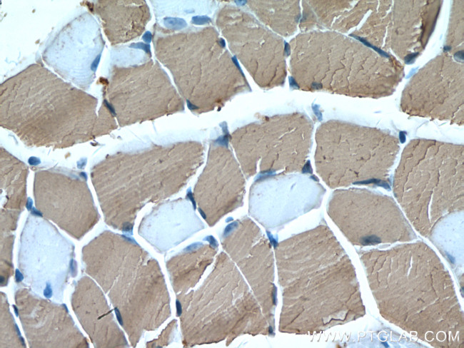 MYH1 Antibody in Immunohistochemistry (Paraffin) (IHC (P))