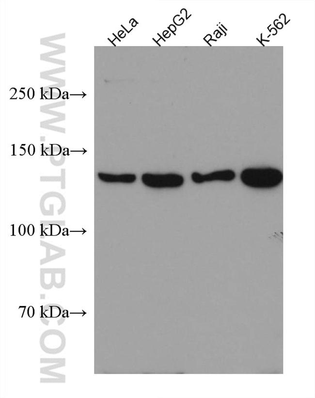 HDAC9 Antibody in Western Blot (WB)