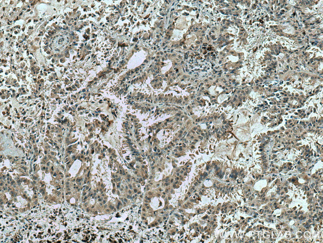 TSG101 Antibody in Immunohistochemistry (Paraffin) (IHC (P))