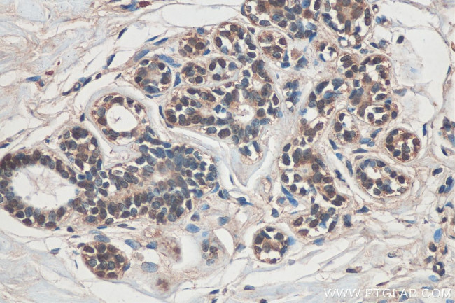 ARID4B Antibody in Immunohistochemistry (Paraffin) (IHC (P))