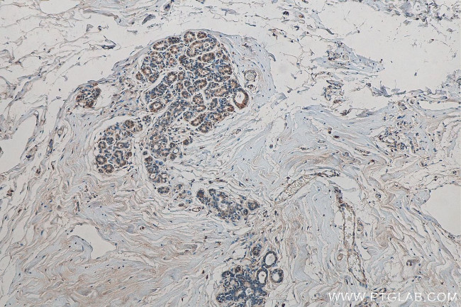 ARID4B Antibody in Immunohistochemistry (Paraffin) (IHC (P))