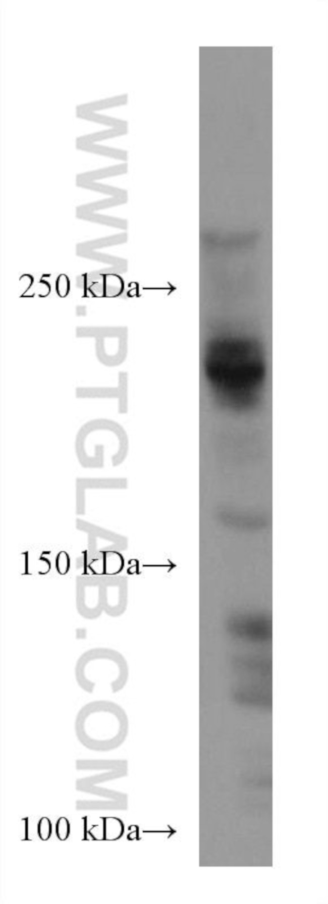 ARID4B Antibody in Western Blot (WB)