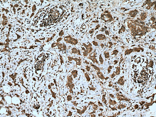 PTPN2 Antibody in Immunohistochemistry (Paraffin) (IHC (P))