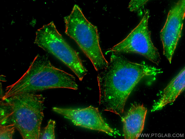 FGL1 Antibody in Immunocytochemistry (ICC/IF)