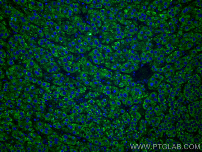 LACTB2 Antibody in Immunohistochemistry (Paraffin) (IHC (P))