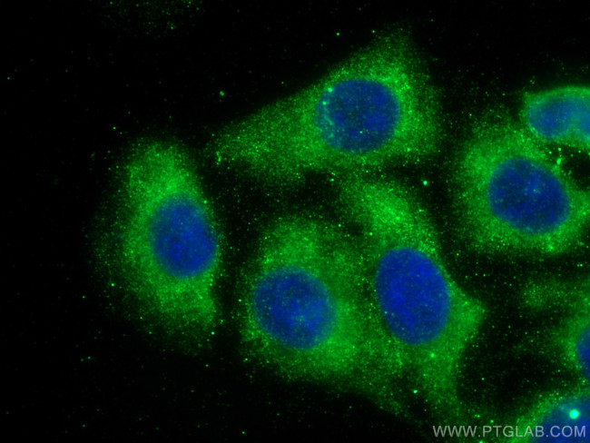 CCT5 Antibody in Immunocytochemistry (ICC/IF)